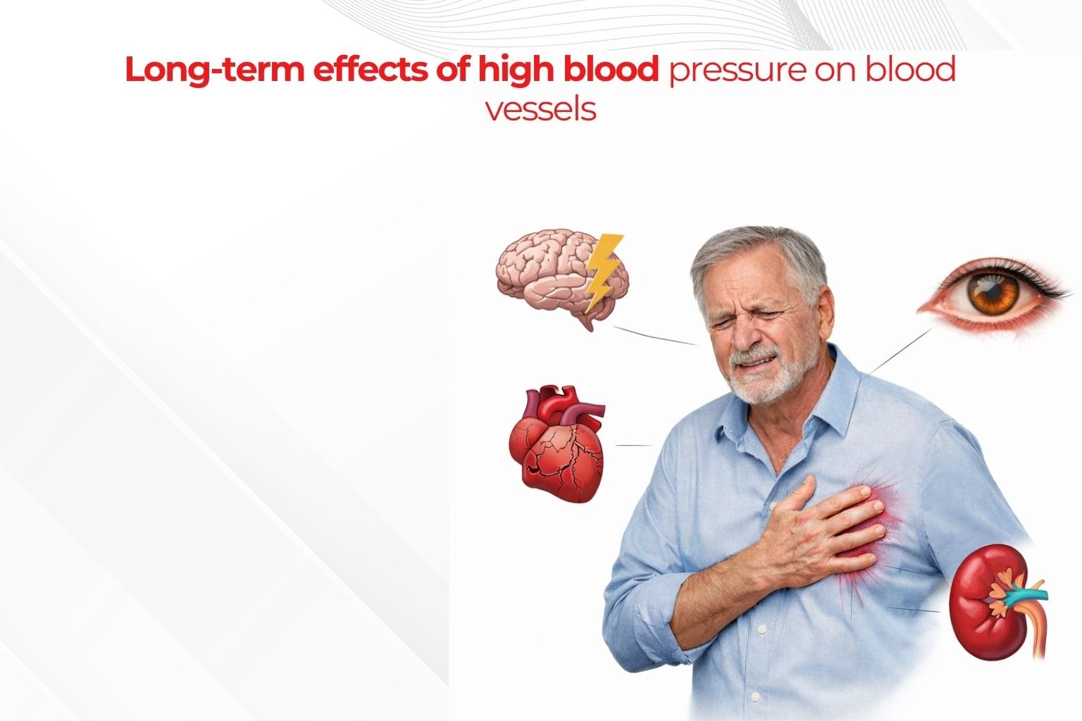Long-term effects of high blood pressure on blood vessels